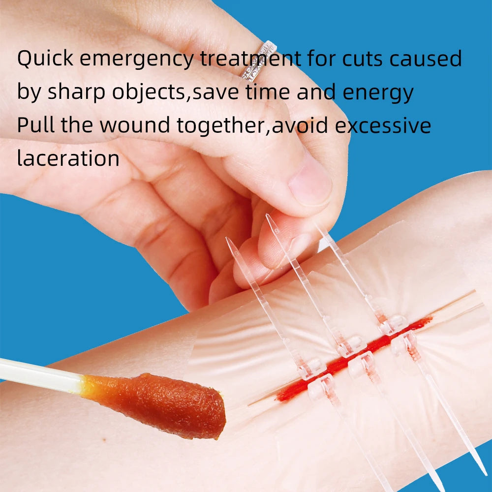 Zipper Band-Aid Wound Closure Device